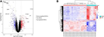 Identification of VCAN as Hub Gene for Diabetic Kidney Disease Immune Injury Using Integrated Bioinformatics Analysis